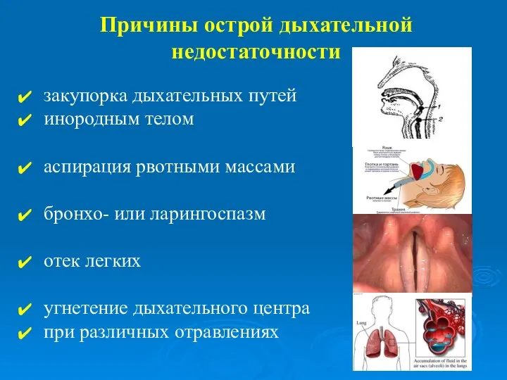 Причины острой дыхательной недостаточности закупорка дыхательных путей инородным телом аспирация рвотными массами