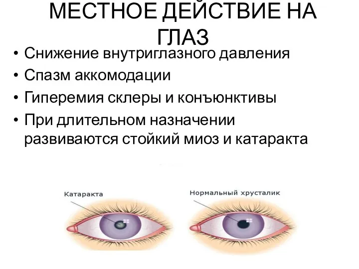 МЕСТНОЕ ДЕЙСТВИЕ НА ГЛАЗ Снижение внутриглазного давления Спазм аккомодации Гиперемия склеры и