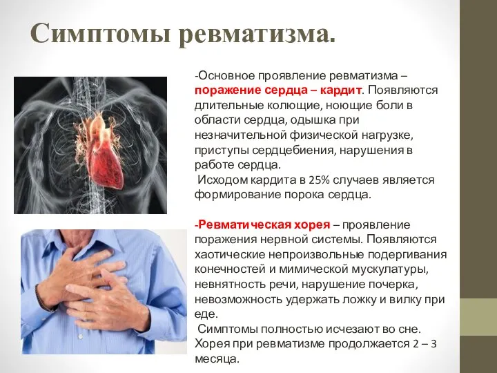 Симптомы ревматизма. -Основное проявление ревматизма – поражение сердца – кардит. Появляются длительные