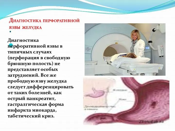 . . Диагностика перфоративной язвы желудка Диагностика перфоративной язвы в типичных случаях