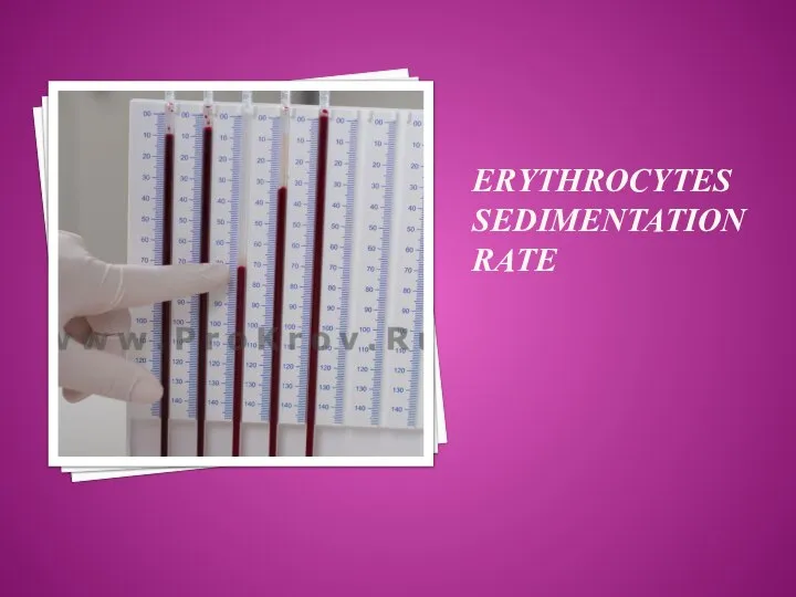 ERYTHROCYTES SEDIMENTATION RATE