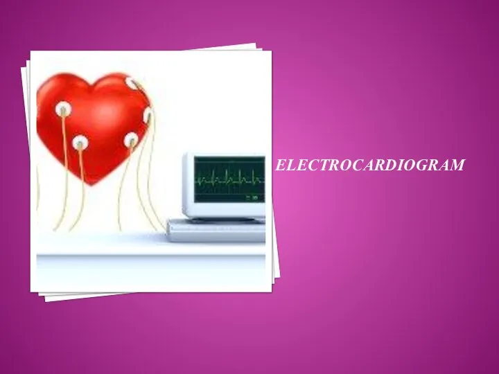 ELECTROCARDIOGRAM