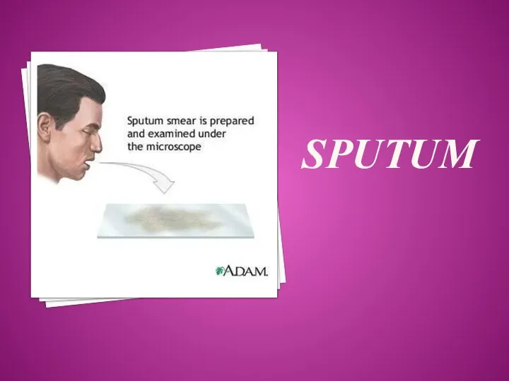 SPUTUM