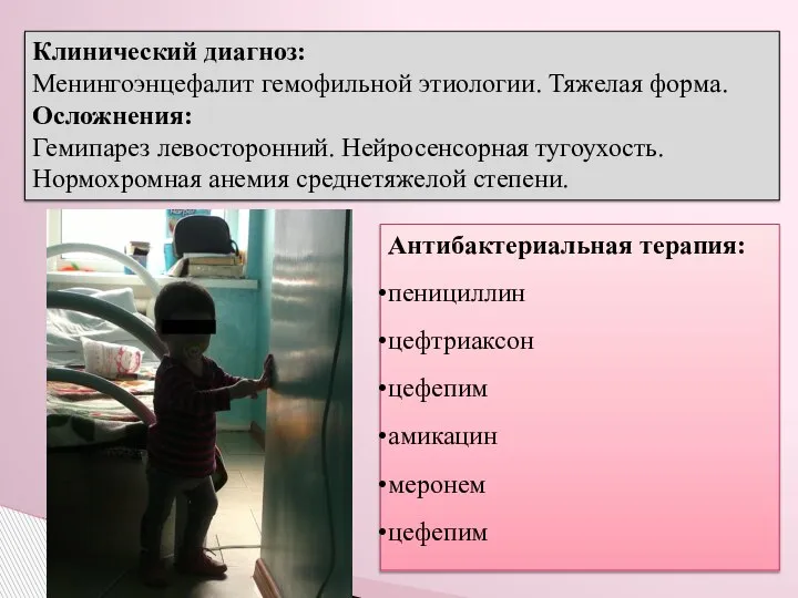 Клинический диагноз: Менингоэнцефалит гемофильной этиологии. Тяжелая форма. Осложнения: Гемипарез левосторонний. Нейросенсорная тугоухость.