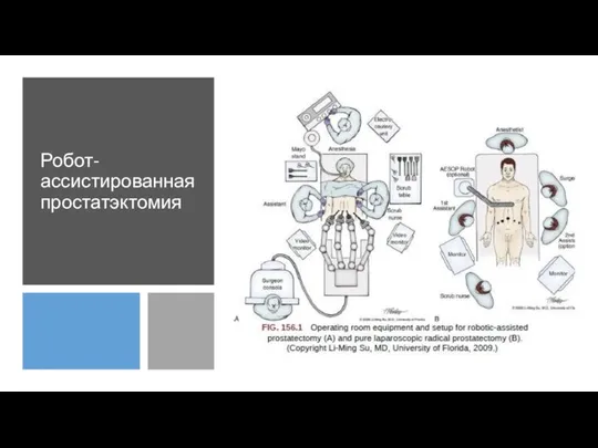 Робот-ассистированная простатэктомия