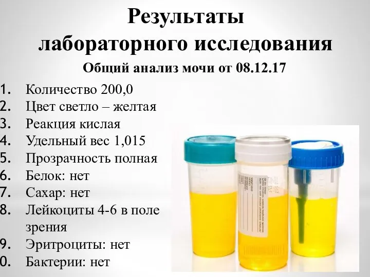 Результаты лабораторного исследования Общий анализ мочи от 08.12.17 Количество 200,0 Цвет светло