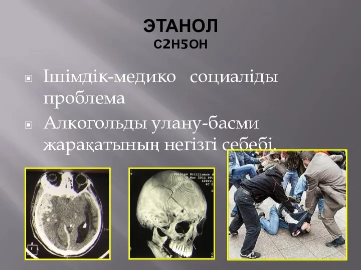 ЭТАНОЛ С2Н5ОН Ішімдік-медико социаліды проблема Алкогольды улану-басми жарақатының негізгі себебі.