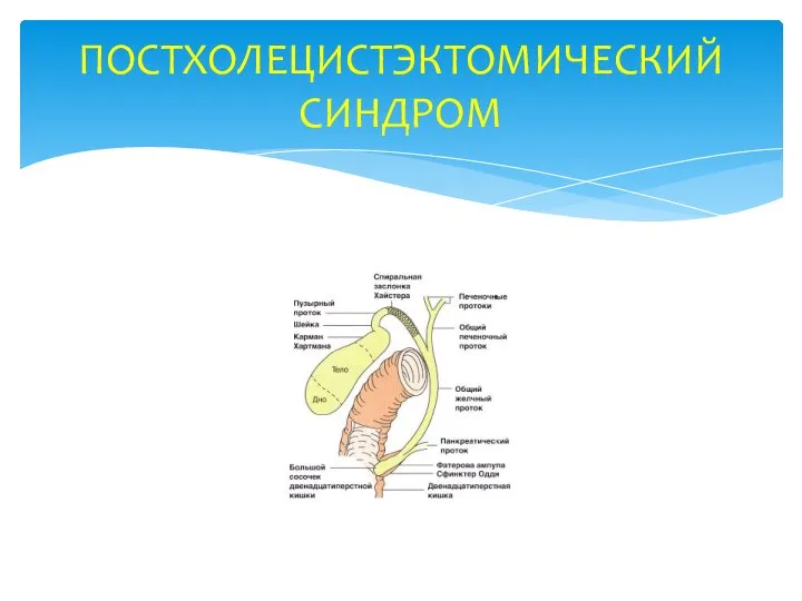 ПОСТХОЛЕЦИСТЭКТОМИЧЕСКИЙ СИНДРОМ