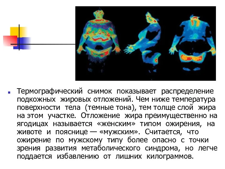 Термографический снимок показывает распределение подкожных жировых отложений. Чем ниже температура поверхности тела
