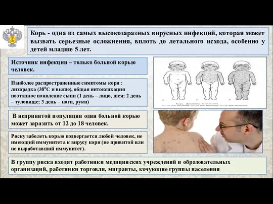 Корь - одна из самых высокозаразных вирусных инфекций, которая может вызвать серьезные