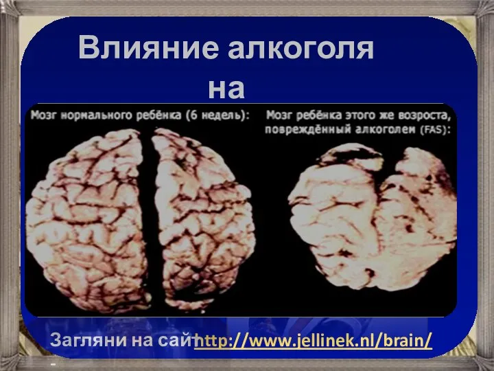 http://www.jellinek.nl/brain/ Загляни на сайт - Влияние алкоголя на мозг человека