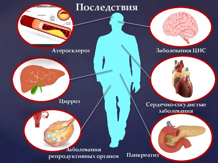 Панкреатит Цирроз Атеросклероз Сердечно-сосудистые заболевания Заболевания репродуктивных органов Заболевания ЦНС Последствия