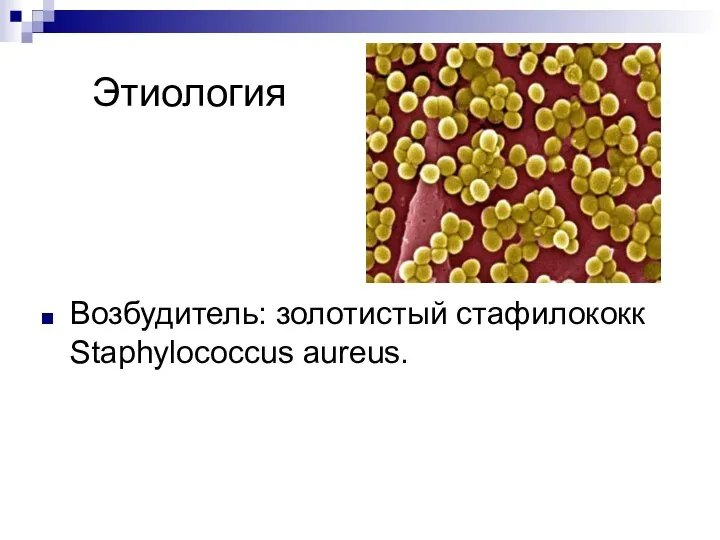 Этиология Возбудитель: золотистый стафилококк Staphylococcus aureus.