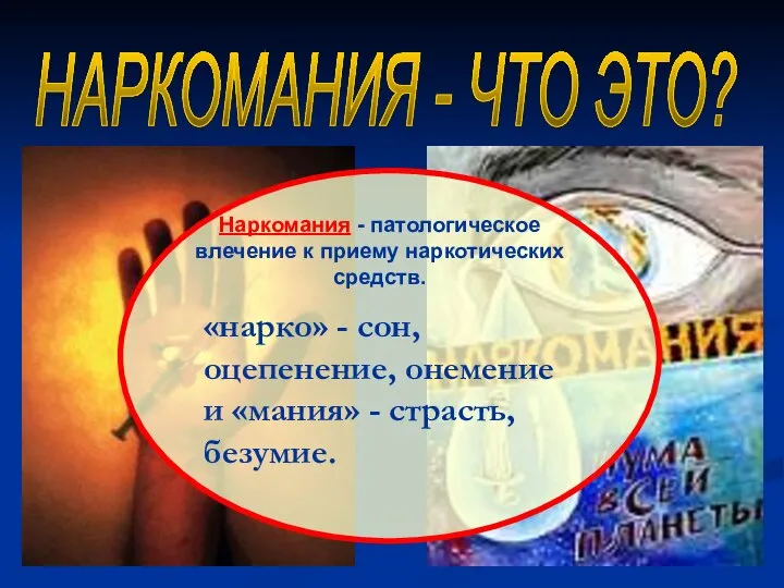 НАРКОМАНИЯ - ЧТО ЭТО? «нарко» - сон, оцепенение, онемение и «мания» - страсть, безумие.