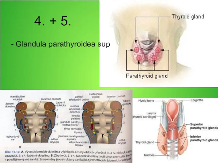 4. + 5. - Glandula parathyroidea sup