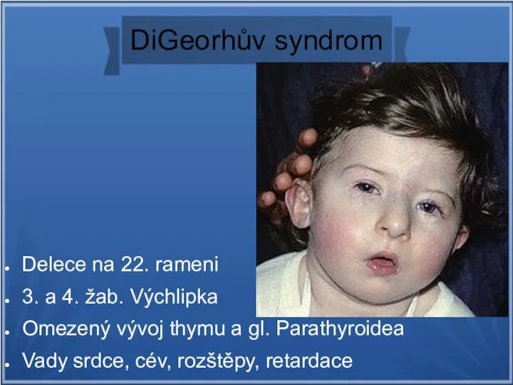 DiGeorhův syndrom Delece na 22. rameni 3. a 4. žab. Výchlipka Omezený