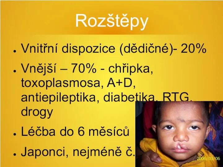 Rozštěpy Vnitřní dispozice (dědičné)- 20% Vnější – 70% - chřipka, toxoplasmosa, A+D,