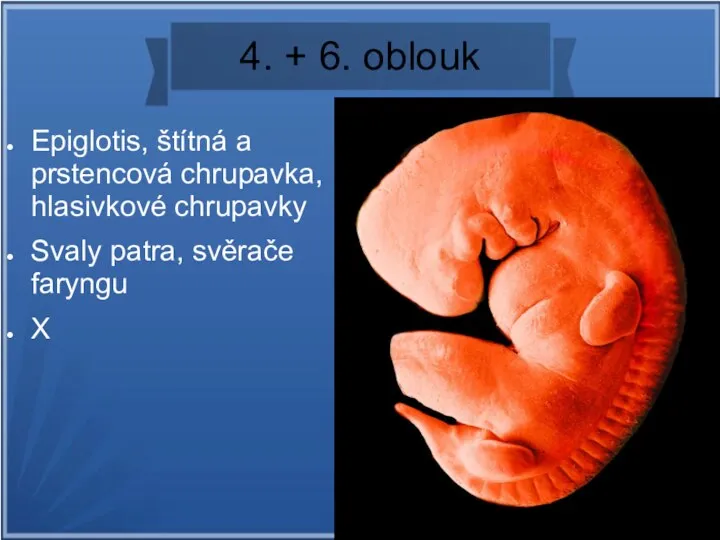 4. + 6. oblouk Epiglotis, štítná a prstencová chrupavka, hlasivkové chrupavky Svaly patra, svěrače faryngu X