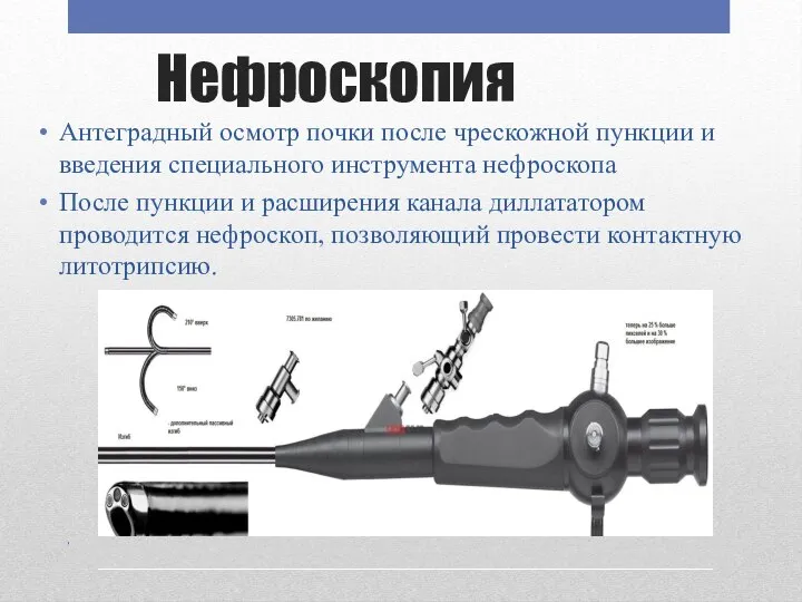 Нефроскопия Антеградный осмотр почки после чрескожной пункции и введения специального инструмента нефроскопа