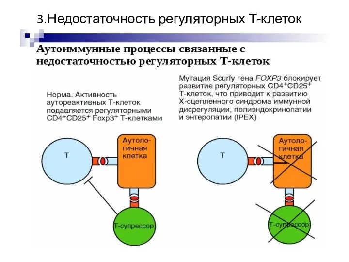 3.Недостаточность регуляторных Т-клеток