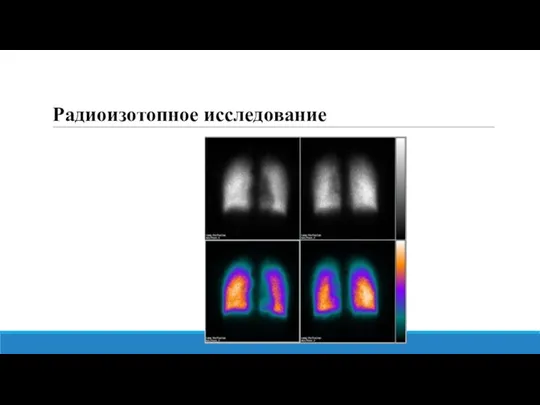 Радиоизотопное исследование