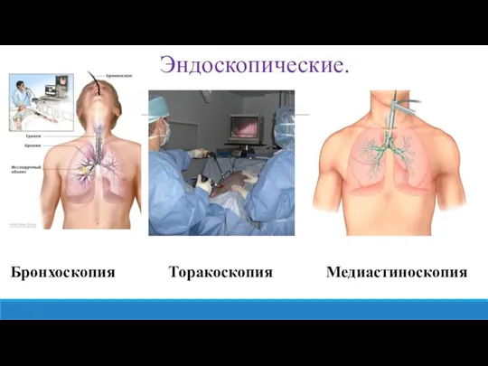 Эндоскопические. Бронхоскопия Торакоскопия Медиастиноскопия