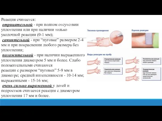 Реакция считается: отрицательной - при полном отсутствии уплотнения или при наличии только