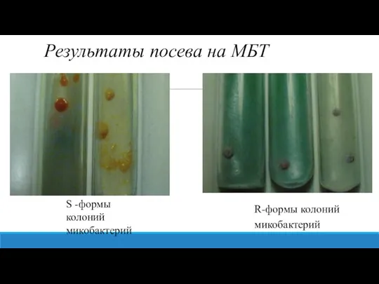 Результаты посева на МБТ S -формы колоний микобактерий R-формы колоний микобактерий