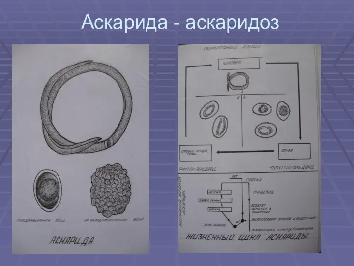 Аскарида - аскаридоз