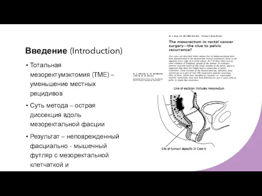 Введение (Introduction) Тотальная мезоректумэктомия (ТМЕ) – уменьшение местных рецидивов Суть метода –