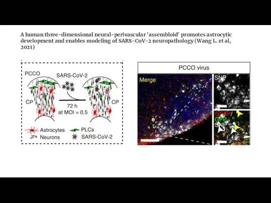 A human three-dimensional neural-perivascular 'assembloid' promotes astrocytic development and enables modeling of