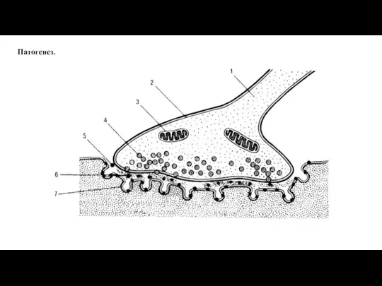 Патогенез.