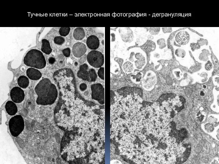 Тучные клетки – электронная фотография - дегрануляция