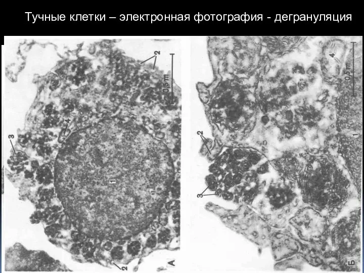 Тучные клетки – электронная фотография - дегрануляция