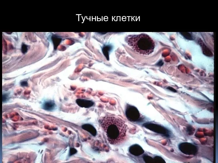 Тучные клетки