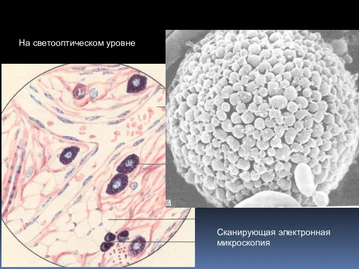 Сканирующая электронная микроскопия На светооптическом уровне