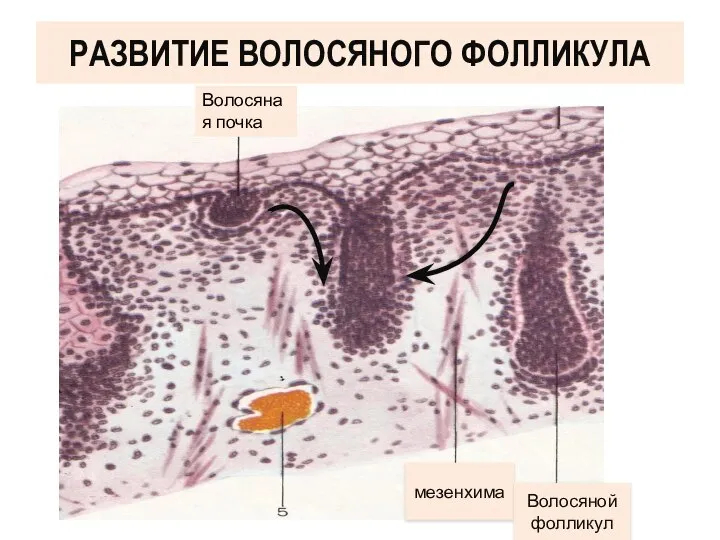 Волосяная почка РАЗВИТИЕ ВОЛОСЯНОГО ФОЛЛИКУЛА мезенхима Волосяной фолликул