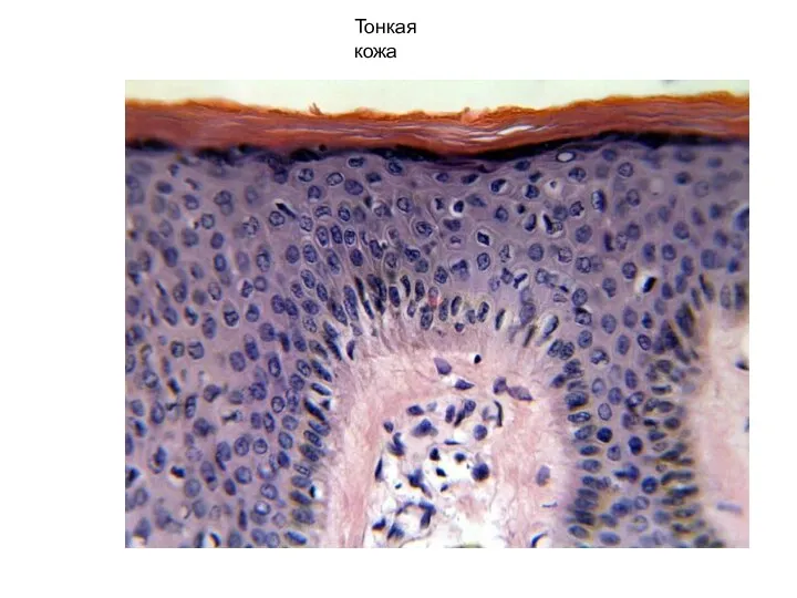 Тонкая кожа