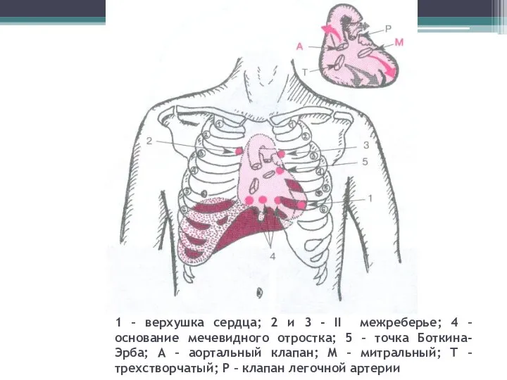 1 – верхушка сердца; 2 и 3 - II межреберье; 4 –