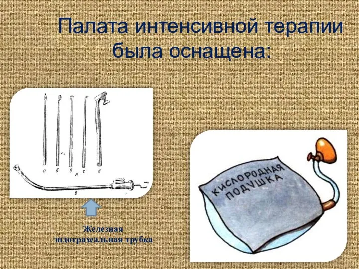 Палата интенсивной терапии была оснащена: Железная эндотрахеальная трубка