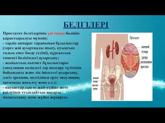 БЕЛГІЛЕРІ Простатит белгілерінің үш топқа бөлініп қарастырылуы мүмкін: - зәрлік аппарат тарапынан