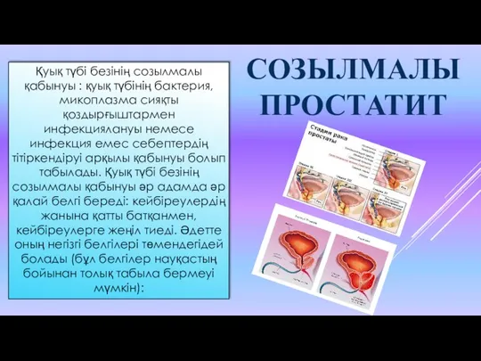 Қуық түбі безінің созылмалы қабынуы : қуық түбінің бактерия, микоплазма сияқты қоздырғыштармен