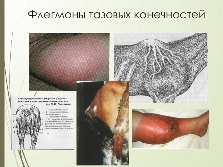 Флегмоны тазовых конечностей