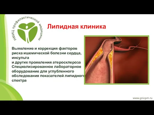 www.gnicpm.ru Липидная клиника Выявление и коррекция факторов риска ишемической болезни сердца, инсульта