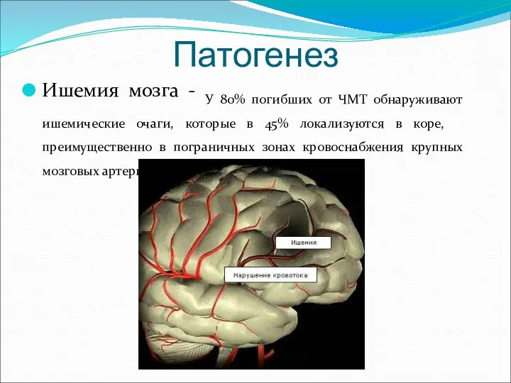 Ишемия мозга - У 80% погибших от ЧМТ обнаруживают ишемические очаги, которые