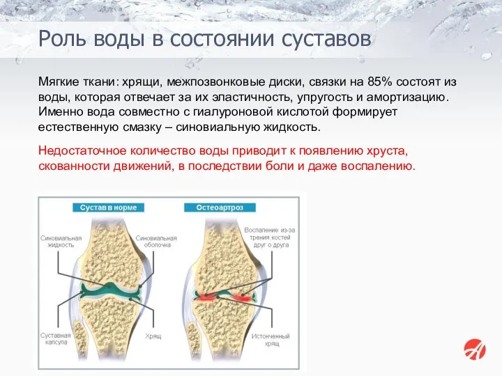 Мягкие ткани: хрящи, межпозвонковые диски, связки на 85% состоят из воды, которая