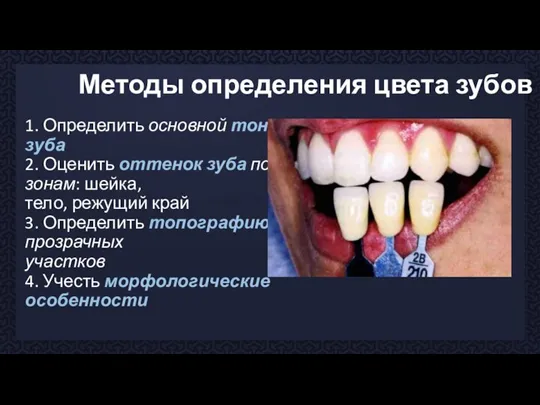 Методы определения цвета зубов 1. Определить основной тон зуба 2. Оценить оттенок