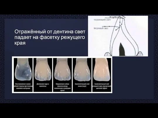 Отражённый от дентина свет падает на фасетку режущего края