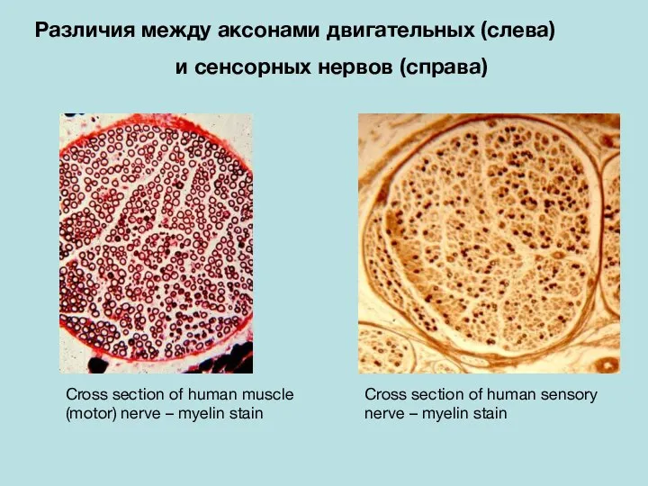 Cross section of human muscle (motor) nerve – myelin stain Cross section