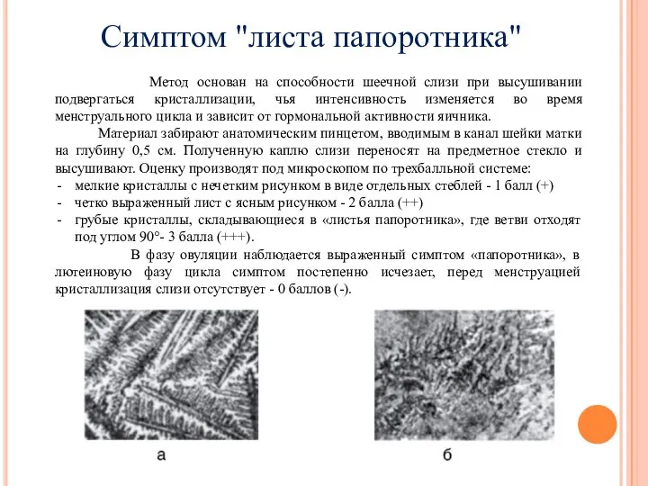 Симптом "листа папоротника" Метод основан на способности шеечной слизи при высушивании подвергаться